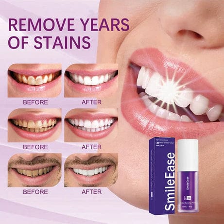 Teeth Brightening Hismiles V34 Colour Corrector Serum – 30ml